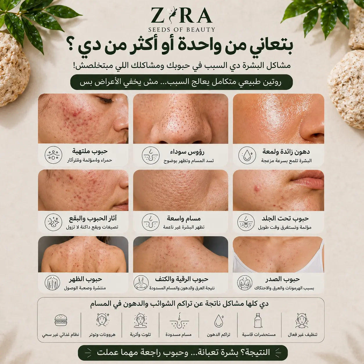 Acne Clear Detox Routine