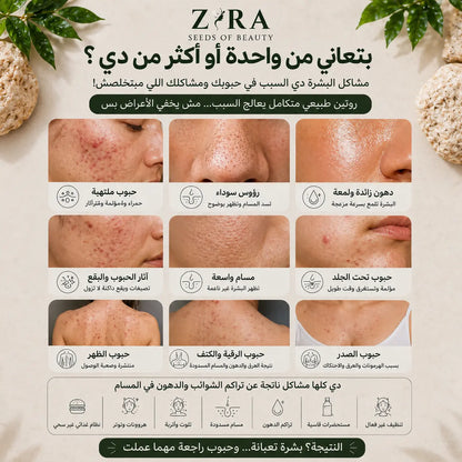 Acne Clear Detox Routine